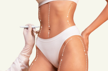 Abdomen