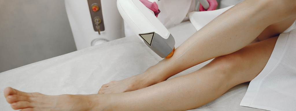 Laser Hair Removal Uncovered